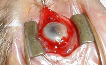 Name:  evis2-Following%20peribulbar%20anaesthesia%2C%20the%20evisceration%20begins%20with%20360%20degre.jpg
Views: 839
Size:  27.9 KB
