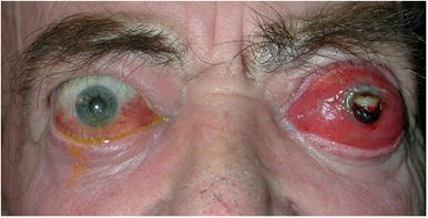eye2012284f5.jpg