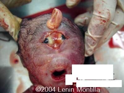 138773d1268657247-baby-deformities-18.jpg
