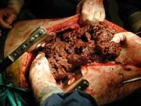 liver%20explosion%20from%20gun.jpg