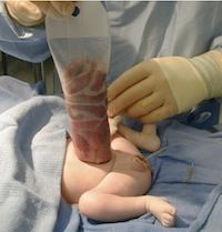 Name:  gastro-2.jpg
Views: 479
Size:  16.5 KB
