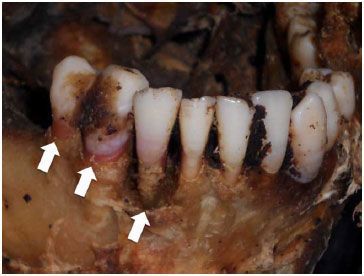 Name:  pink%20tooth%20indicates%20strangulation%20drowing%20or%20suffocation.jpg
Views: 446
Size:  24.5 KB