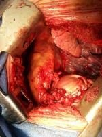 Name:  blast%20injury%20to%20diaphragm.jpg
Views: 481
Size:  19.5 KB