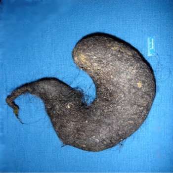 bola-de-pelo1.jpg
