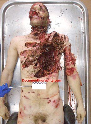 bearattackvictim1.jpg