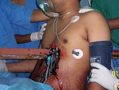 Name:  phpThumb_generated_thumbnailjpg.jpg
Views: 343
Size:  22.4 KB