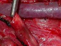 Name:  gswcarotid05_thumb.jpg
Views: 332
Size:  4.9 KB