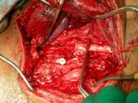 Name:  gswcarotid06_thumb.jpg
Views: 339
Size:  5.8 KB