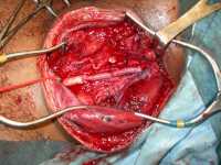 Name:  gswcarotid07_thumb.jpg
Views: 337
Size:  6.1 KB