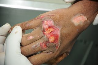 Name:  Picture%20035.jpg
Views: 306
Size:  20.1 KB