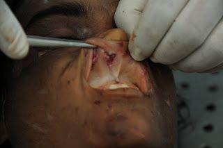 Name:  Picture%20070.jpg
Views: 305
Size:  11.8 KB