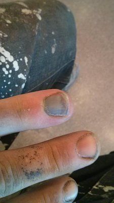 finger_top.jpg