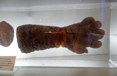 Name:  deformed-arm-hand-ellis-pathological-museum-siriraj-medical-museum-bangkok-thailand.JPG
Views: 461
Size:  21.6 KB