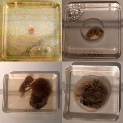 Name:  foetus-development-medley-ellis-pathological-museum-siriraj-medical-museum-bangkok-thailand.jpg
Views: 412
Size:  44.5 KB