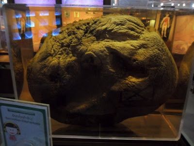 Name:  scrotum-severity-elaphantiasis-parasitology-museum-siriraj-medical-museum-bangkok-thailand.JPG
Views: 416
Size:  35.4 KB