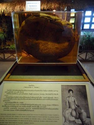 Name:  scrotum-severity-elephantiasis-info-parasitology-museum-siriraj-medical-museum-bangkok-thailand.JPG
Views: 416
Size:  39.2 KB