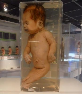 Name:  sirenomelia-mermaid-ellis-pathological-museum-siriraj-medical-museum-bangkok-thailand.JPG
Views: 416
Size:  25.7 KB