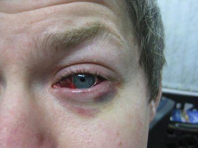 eye-201.jpg