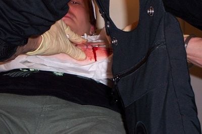 skin-seperating-2.jpg