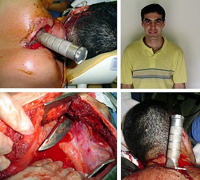 knifed.jpg