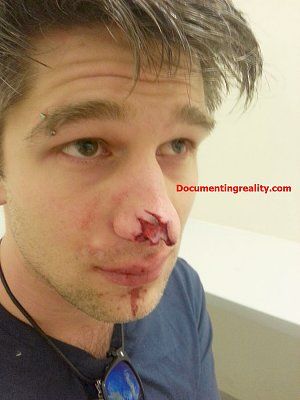 dognose11.jpg