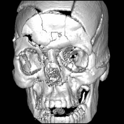 complexskull01.jpg