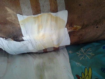 legs-rotting-off-02.jpg