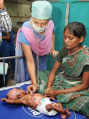 596209d1419667378-baby-who-catches-himself-fire-rahul-2002.jpg