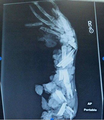 meat-grinderx-ray.jpg