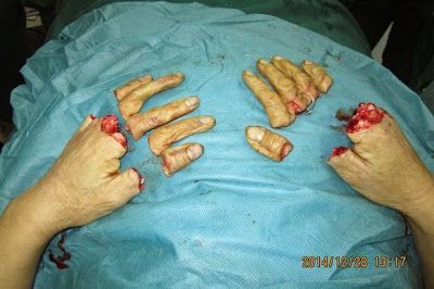 severed1.jpg