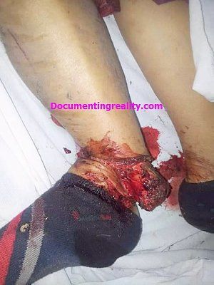 ankle100.jpg