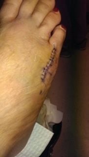 605650d1423446512-heels-booze-broken-foot-image.jpg