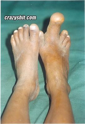 061808_penis_toe.jpg