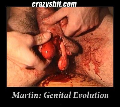 061108_genital_mutilation.jpg