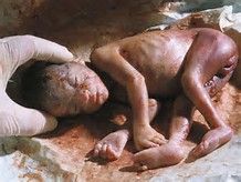 abortion%2024%20weeks.jpg