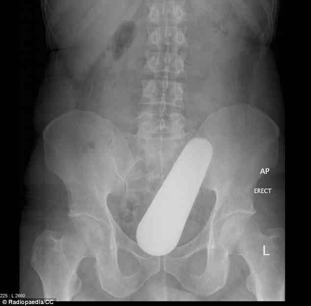 255B304600000578-2940869-_40_year_old_man_slipped_while_cooking_Malaysian_food_-m-65_14231339600.jpg