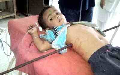Six-year-old_boy_impaled_on_metal_pole-1.jpg