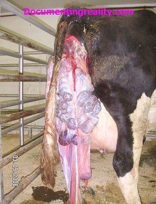 uterus-20prolapse1.jpg