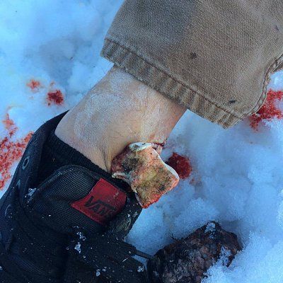 rock-climbing-accident.jpg