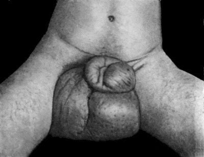fig098.jpg