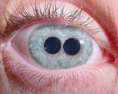 two%20pupils.jpg