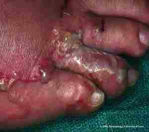 toes.jpg
