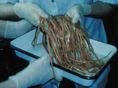 1785286-roundworms-1.jpg
