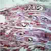 Trichinella_larvaeD.jpg