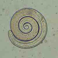 Trichinella_larvaeG.JPG
