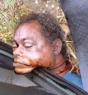 409940d1353397019-gruesome-neck-injury-led-death-after-car-accident-carro.jpg