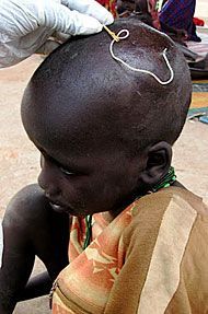 Name:  lotepi-lokusi-3.jpg
Views: 131
Size:  19.4 KB