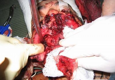 gunshot-face-iraq-01.jpg