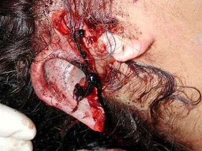 ear.jpg