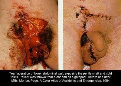 grosspenis.jpg